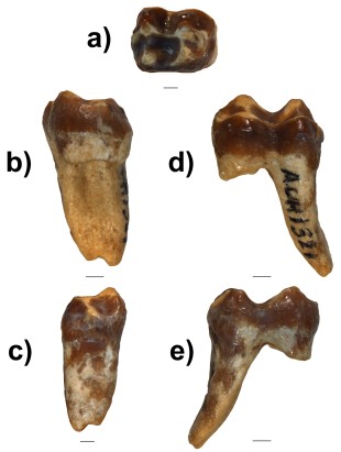 Images of the fossil tooth in multiple angles. Scale bar = 5mm. Photo by E. Lazlo-Wasem.